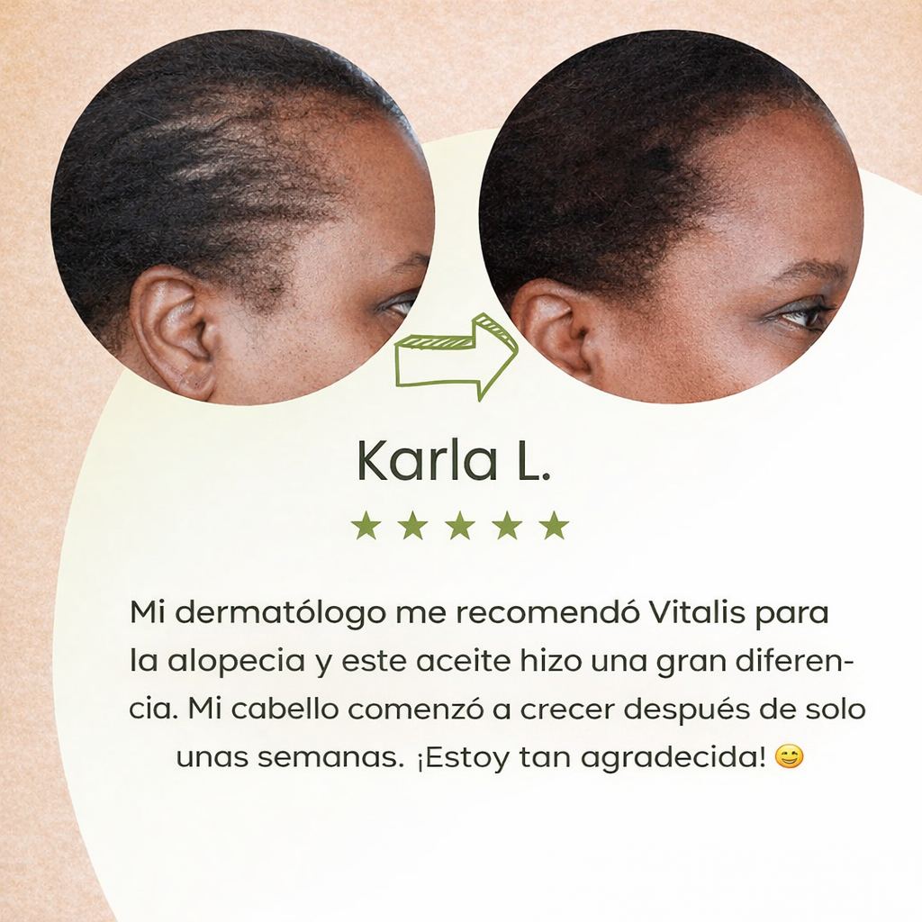 HairBoost™ – Sérum de Crecimiento Natural