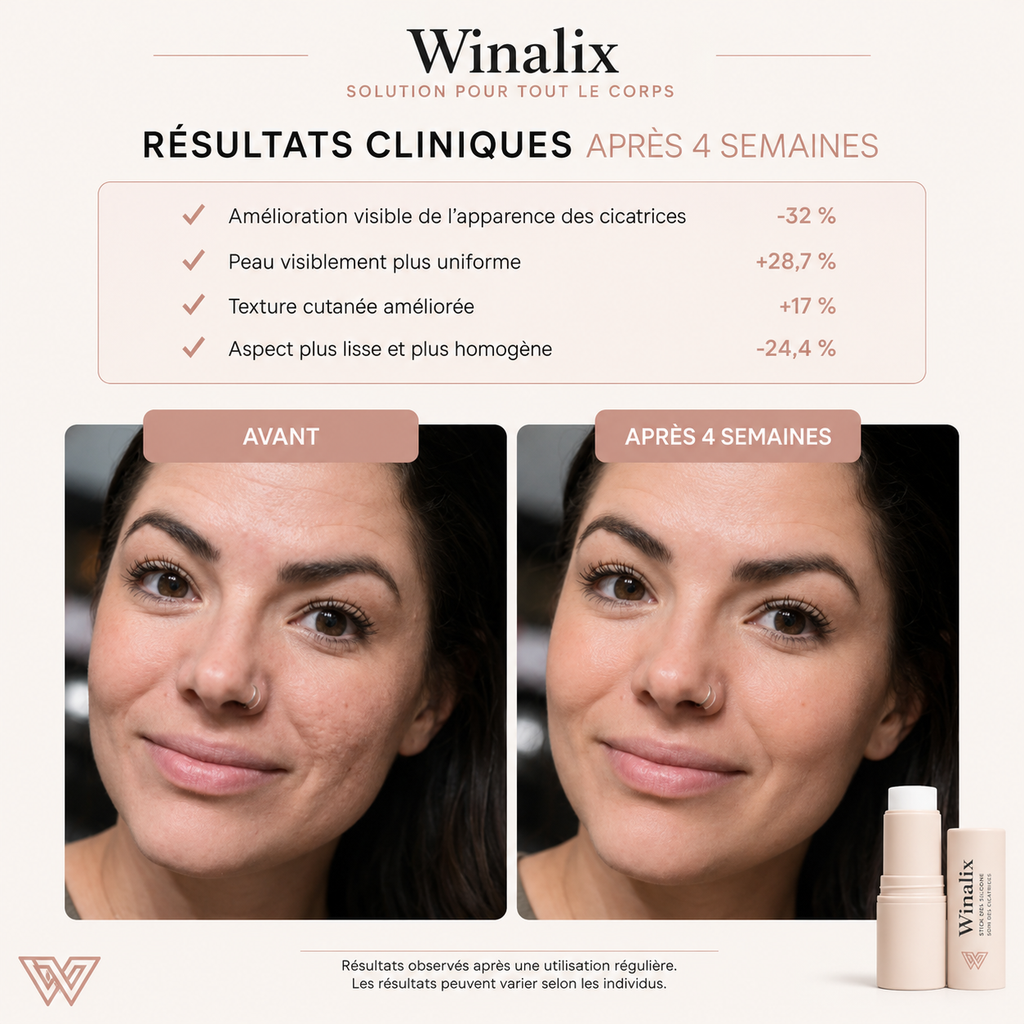 Winalix™ │Stick Silicone Anti-cicatrice