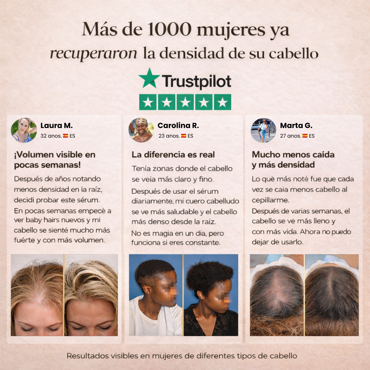 HairBoost™ – Sérum de Crecimiento Natural